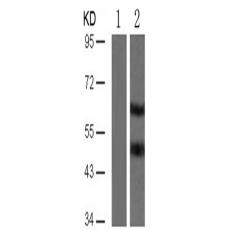 兔抗MAPT (Phospho-Ser356)多克隆抗體