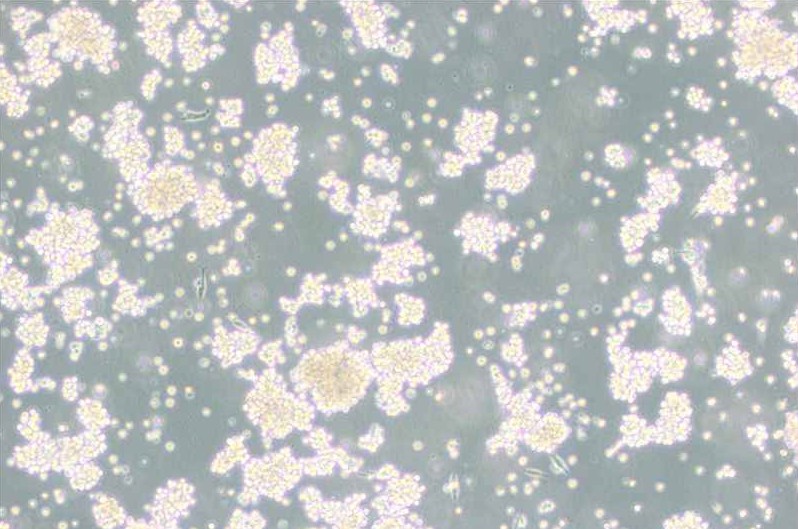 B95-8絨猴EB病毒轉(zhuǎn)化的白細胞